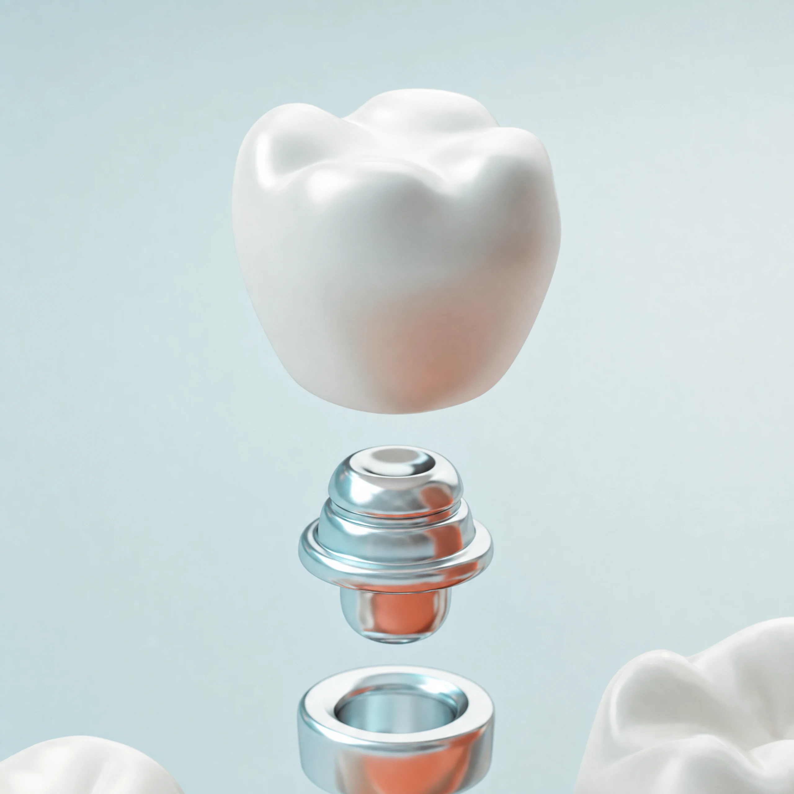 Dental implant procedure